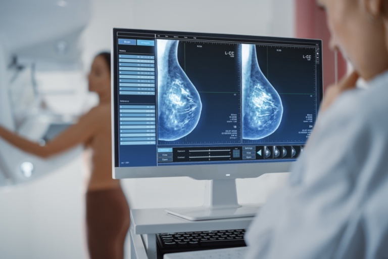 Wire localization of breast cancers can save lives
